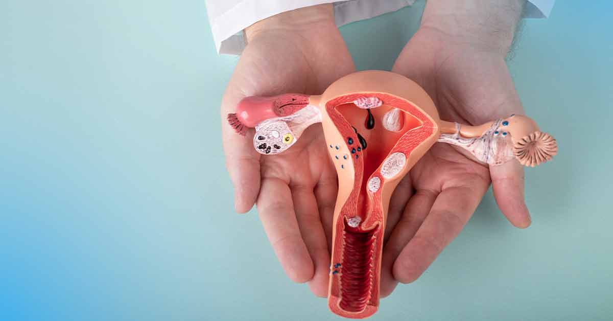 Setubal, M. (2024). 5 sintomas mais comuns da endometriose - Conheça. Hospital E Maternidade Santa Joana. (Disponível em 9/12/2024)