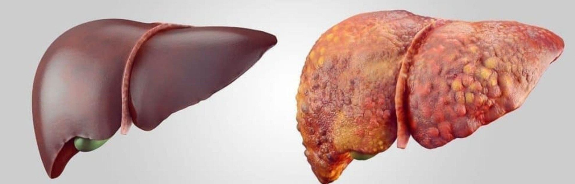 News, P. (2018). Why is it Important to Keep our Liver in Good Shape? Tires & Parts News. (Disponível em 9/12/2024)
